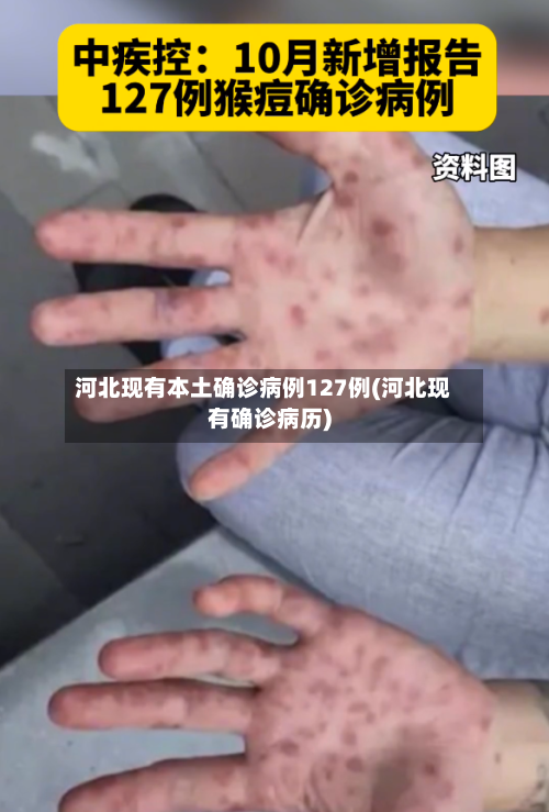 河北现有本土确诊病例127例(河北现有确诊病历)