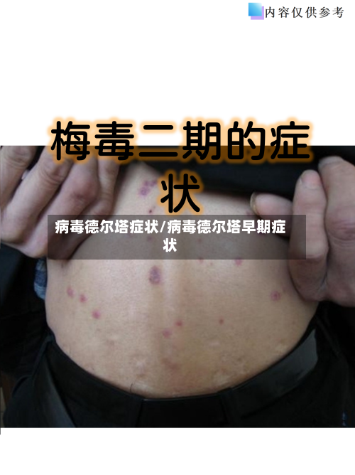 病毒德尔塔症状/病毒德尔塔早期症状